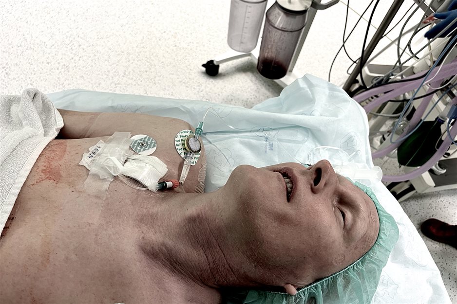 November 2024, before the surgery, will I wake up?